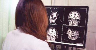 Científicos descubren causas del avance del mal de Alzheimer en el cerebro